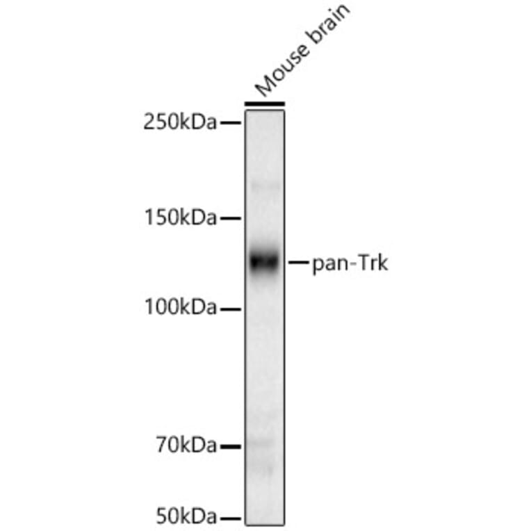 Western Blot - Anti-TrkA Antibody (A329929) - Antibodies.com