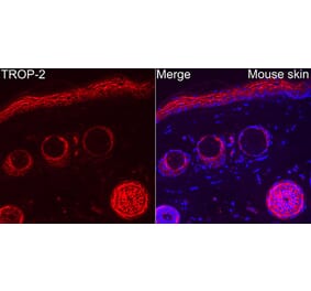 Immunofluorescence - Anti-TROP2 Antibody (A329930) - Antibodies.com
