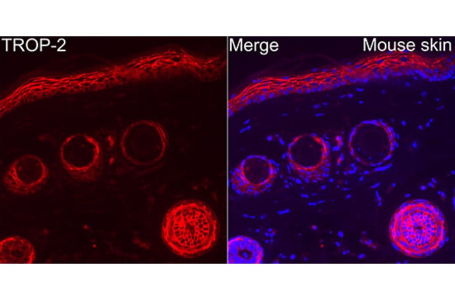 Immunofluorescence - Anti-TROP2 Antibody (A329930) - Antibodies.com