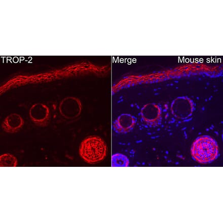 Immunofluorescence - Anti-TROP2 Antibody (A329930) - Antibodies.com