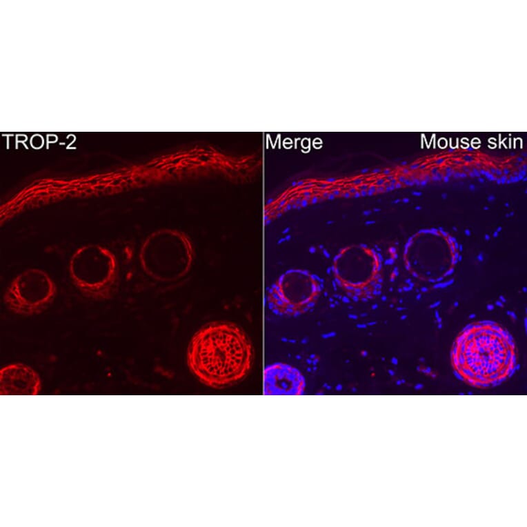 Immunofluorescence - Anti-TROP2 Antibody (A329930) - Antibodies.com