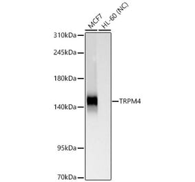 Western Blot - Anti-TRPM4 Antibody [ARC65174] (A329931) - Antibodies.com