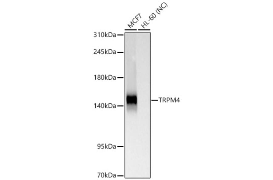 Western Blot - Anti-TRPM4 Antibody [ARC65174] (A329931) - Antibodies.com