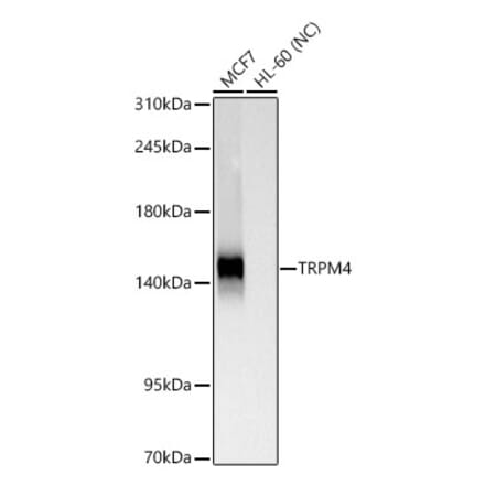 Western Blot - Anti-TRPM4 Antibody [ARC65174] (A329931) - Antibodies.com