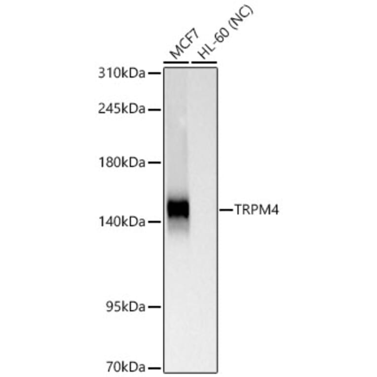 Western Blot - Anti-TRPM4 Antibody [ARC65174] (A329931) - Antibodies.com