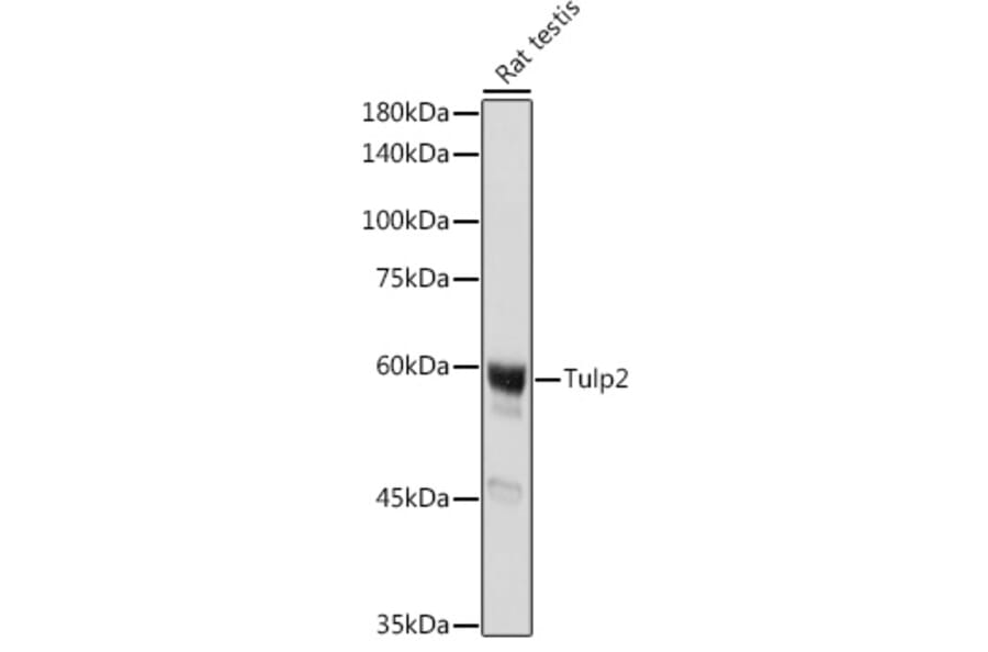 Western Blot - Anti-TULP2 Antibody (A329933) - Antibodies.com