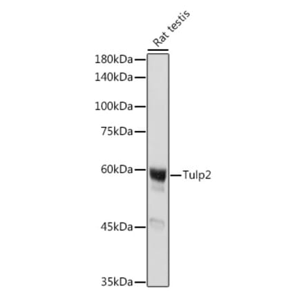 Western Blot - Anti-TULP2 Antibody (A329933) - Antibodies.com
