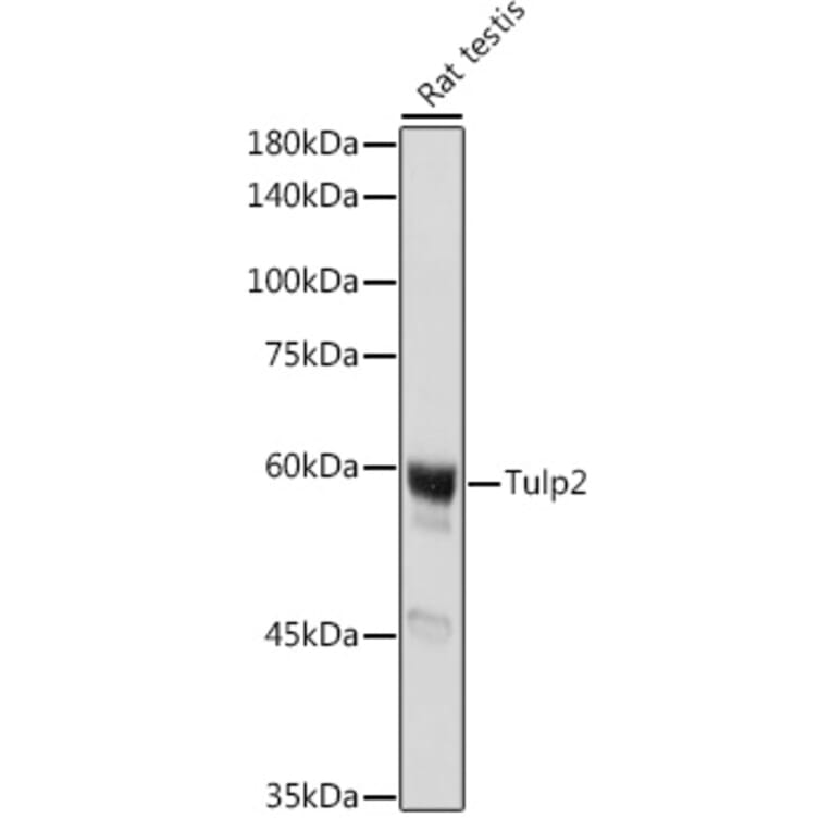 Western Blot - Anti-TULP2 Antibody (A329933) - Antibodies.com
