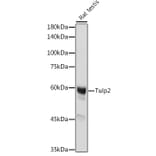 Western Blot - Anti-TULP2 Antibody (A329933) - Antibodies.com