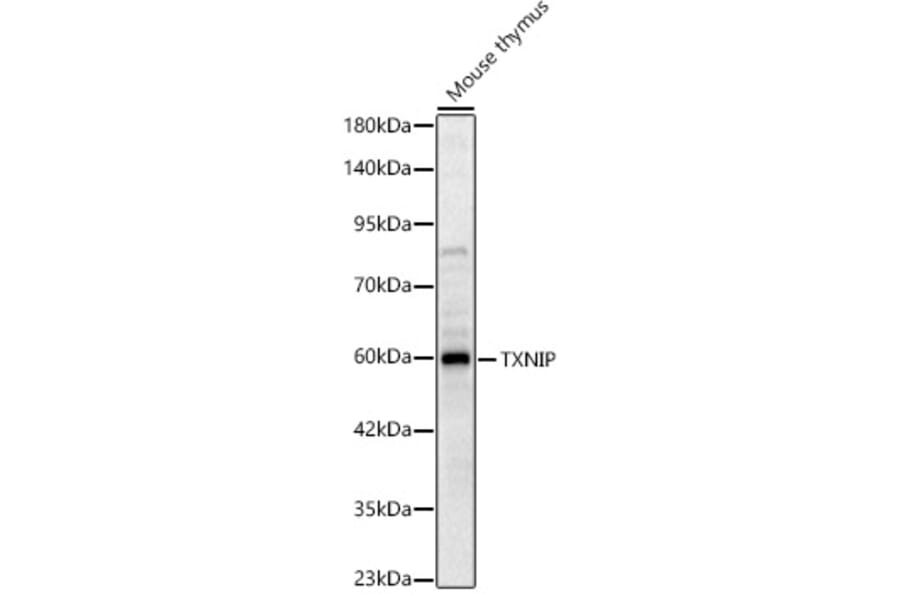 Western Blot - Anti-TXNIP Antibody (A329934) - Antibodies.com
