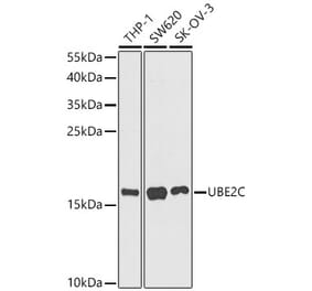 Western Blot - Anti-UBE2C Antibody (A329936) - Antibodies.com