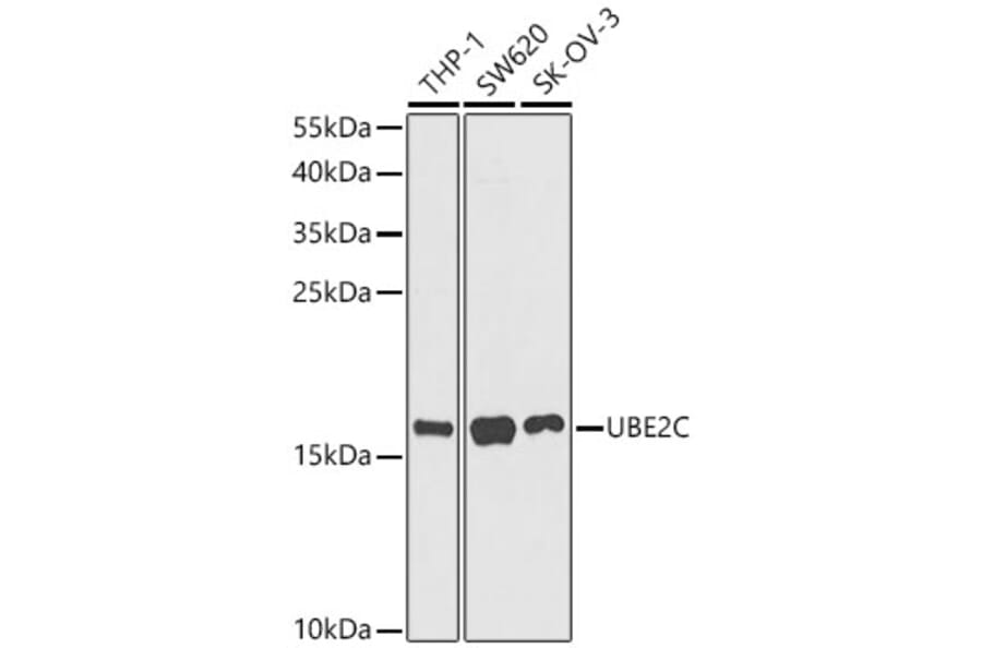 Western Blot - Anti-UBE2C Antibody (A329936) - Antibodies.com