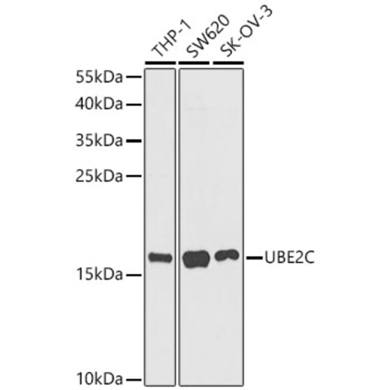 Western Blot - Anti-UBE2C Antibody (A329936) - Antibodies.com