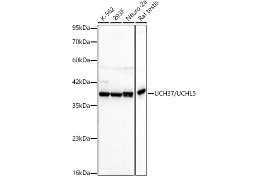 Western Blot - Anti-UCH37 Antibody [ARC60845] (A329937) - Antibodies.com