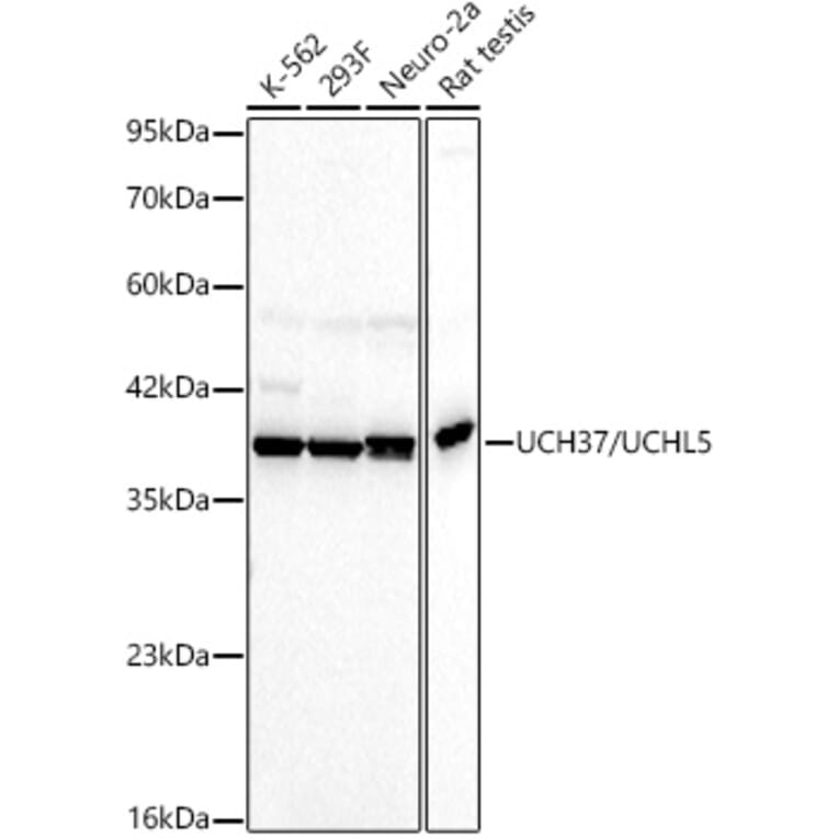 Western Blot - Anti-UCH37 Antibody [ARC60845] (A329937) - Antibodies.com