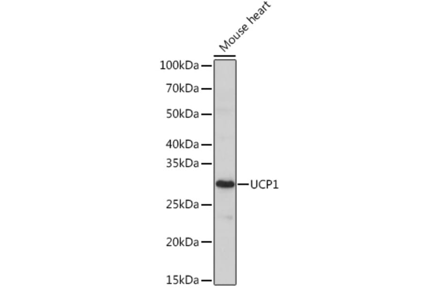 Western Blot - Anti-UCP1 Antibody (A329938) - Antibodies.com