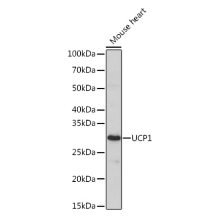 Western Blot - Anti-UCP1 Antibody (A329938) - Antibodies.com