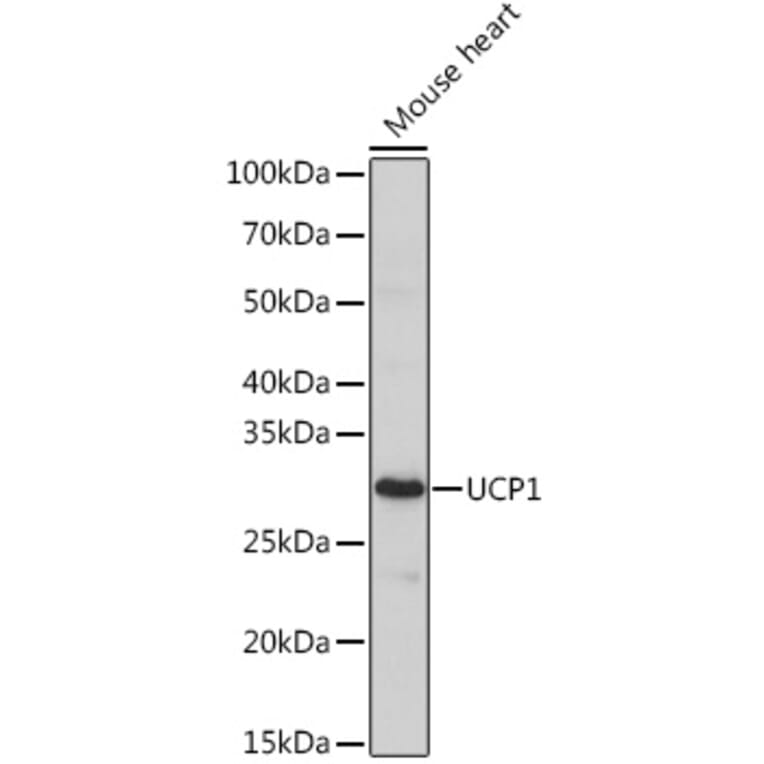 Western Blot - Anti-UCP1 Antibody (A329938) - Antibodies.com