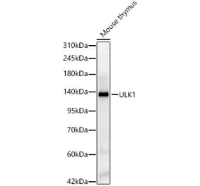 Western Blot - Anti-ULK1 Antibody (A329940) - Antibodies.com