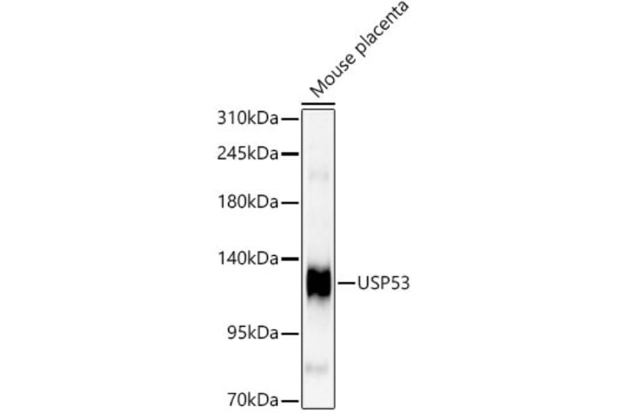 Western Blot - Anti-USP53 Antibody (A329943) - Antibodies.com