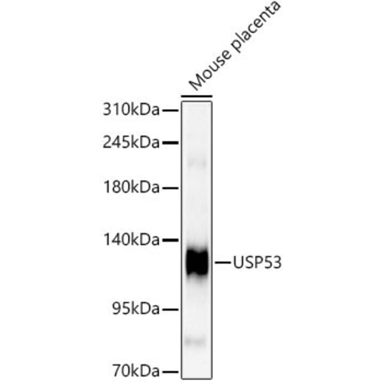 Western Blot - Anti-USP53 Antibody (A329943) - Antibodies.com
