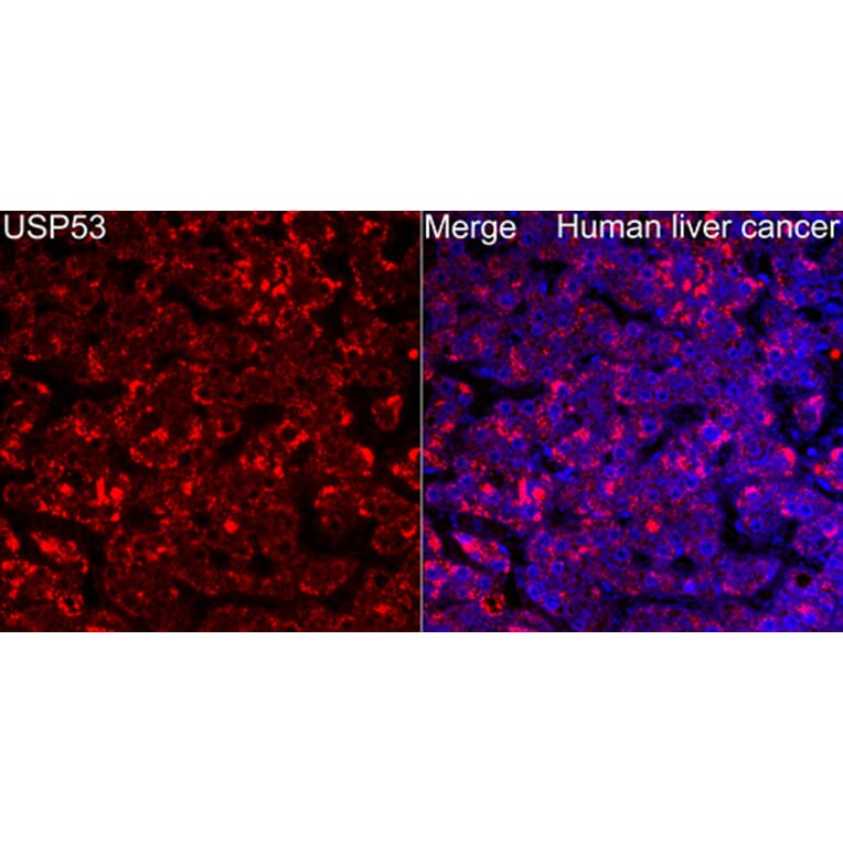 Immunofluorescence - Anti-USP53 Antibody (A329943) - Antibodies.com