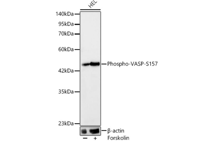 Western Blot - Anti-VASP (Phospho S157) Antibody [ARC64201] (A329944) - Antibodies.com