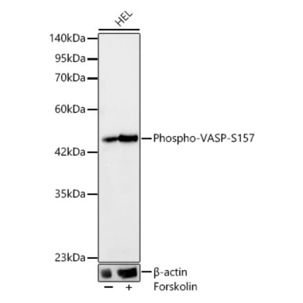 Western Blot - Anti-VASP (Phospho S157) Antibody [ARC64201] (A329944) - Antibodies.com