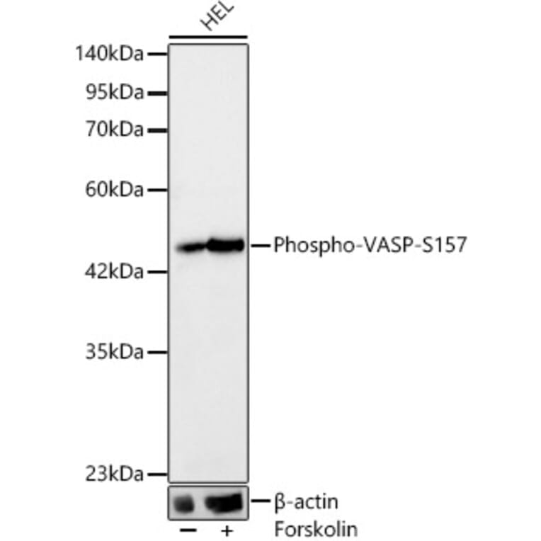 Western Blot - Anti-VASP (Phospho S157) Antibody [ARC64201] (A329944) - Antibodies.com