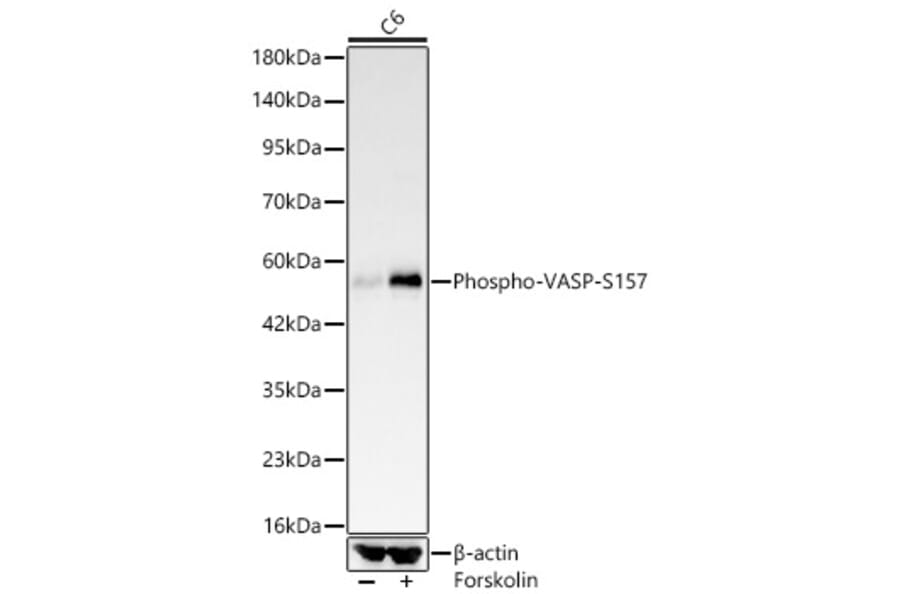 Western Blot - Anti-VASP (Phospho S157) Antibody [ARC64203] (A329945) - Antibodies.com