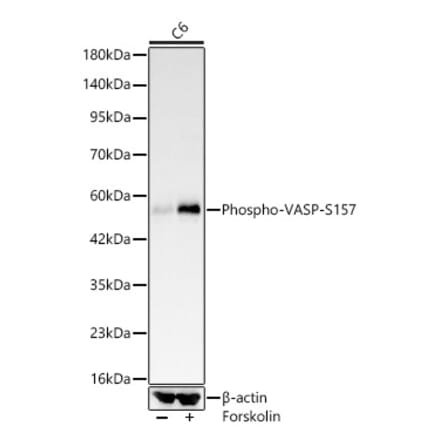 Western Blot - Anti-VASP (Phospho S157) Antibody [ARC64203] (A329945) - Antibodies.com