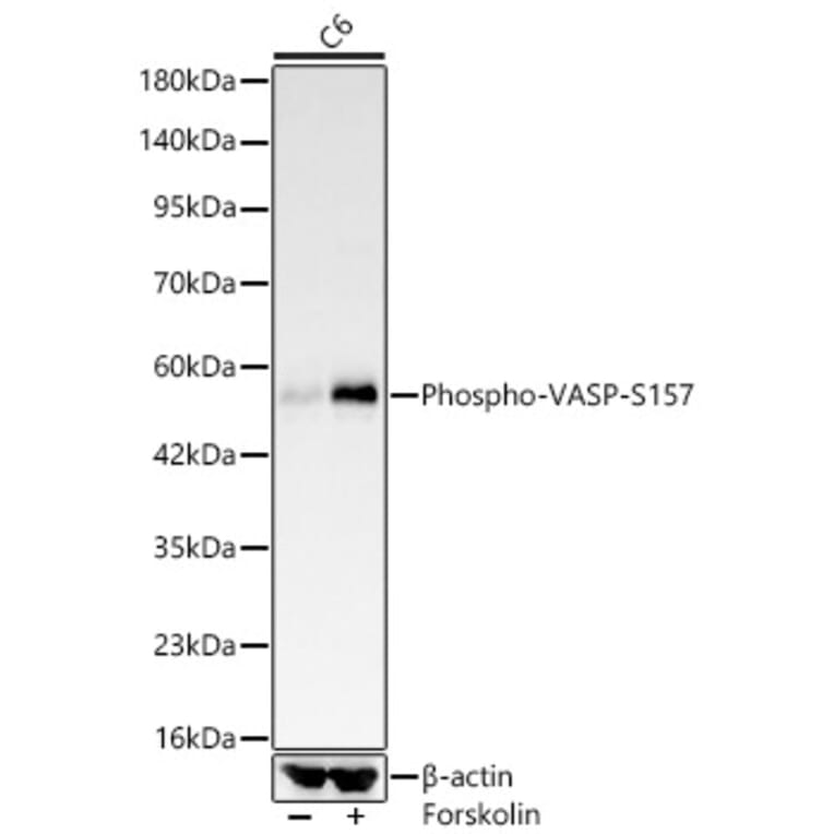 Western Blot - Anti-VASP (Phospho S157) Antibody [ARC64203] (A329945) - Antibodies.com