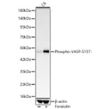 Western Blot - Anti-VASP (Phospho S157) Antibody [ARC64203] (A329945) - Antibodies.com