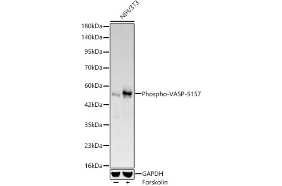 Western Blot - Anti-VASP (Phospho S157) Antibody [ARC64203] (A329945) - Antibodies.com