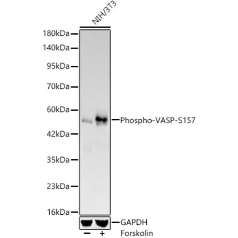 Western Blot - Anti-VASP (Phospho S157) Antibody [ARC64203] (A329945) - Antibodies.com