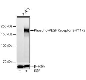 Western Blot - Anti-VEGF Receptor 2 (Phospho Y1175) Antibody [ARC66441] (A329949) - Antibodies.com