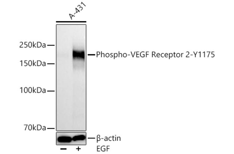 Western Blot - Anti-VEGF Receptor 2 (Phospho Y1175) Antibody [ARC66441] (A329949) - Antibodies.com