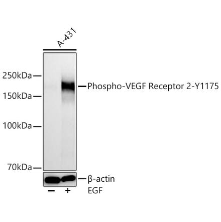 Western Blot - Anti-VEGF Receptor 2 (Phospho Y1175) Antibody [ARC66441] (A329949) - Antibodies.com