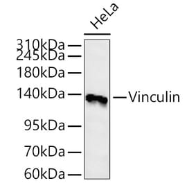 Western Blot - Anti-Vinculin Antibody (A329959) - Antibodies.com