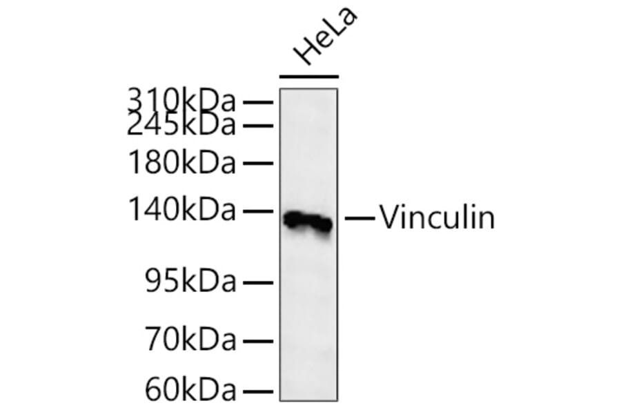 Western Blot - Anti-Vinculin Antibody (A329959) - Antibodies.com