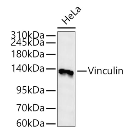 Western Blot - Anti-Vinculin Antibody (A329959) - Antibodies.com