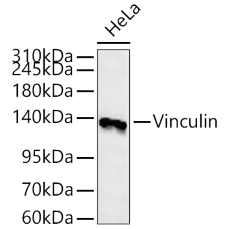 Western Blot - Anti-Vinculin Antibody (A329959) - Antibodies.com