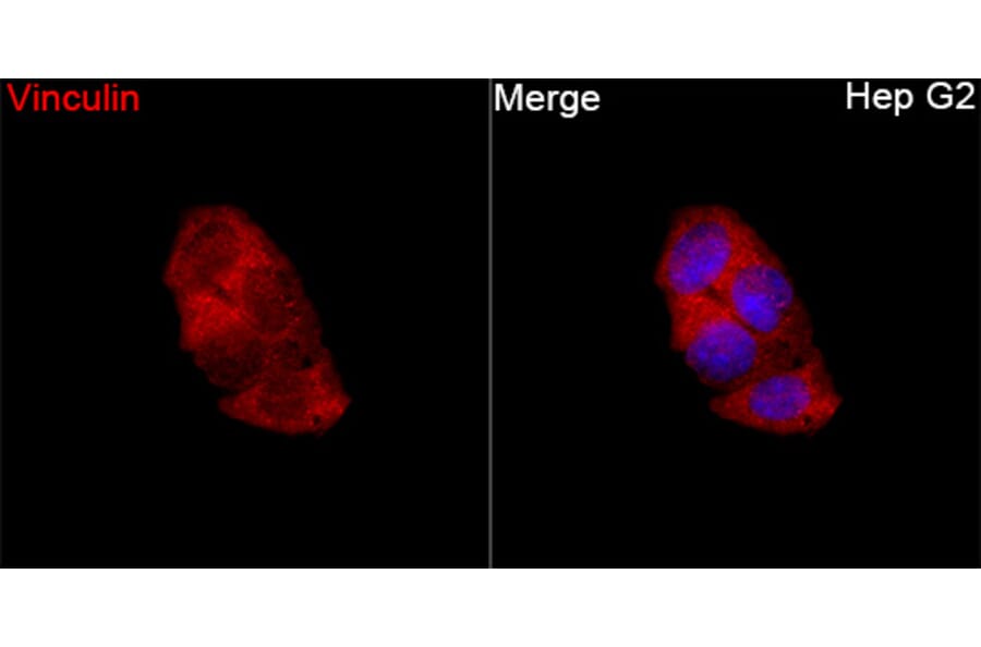 Immunofluorescence - Anti-Vinculin Antibody (A329959) - Antibodies.com