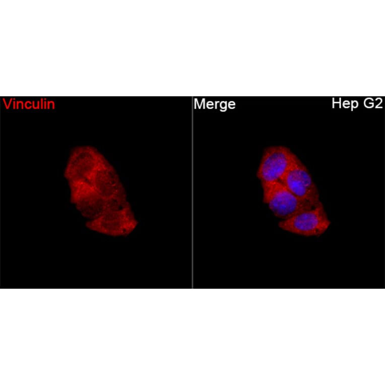 Immunofluorescence - Anti-Vinculin Antibody (A329959) - Antibodies.com