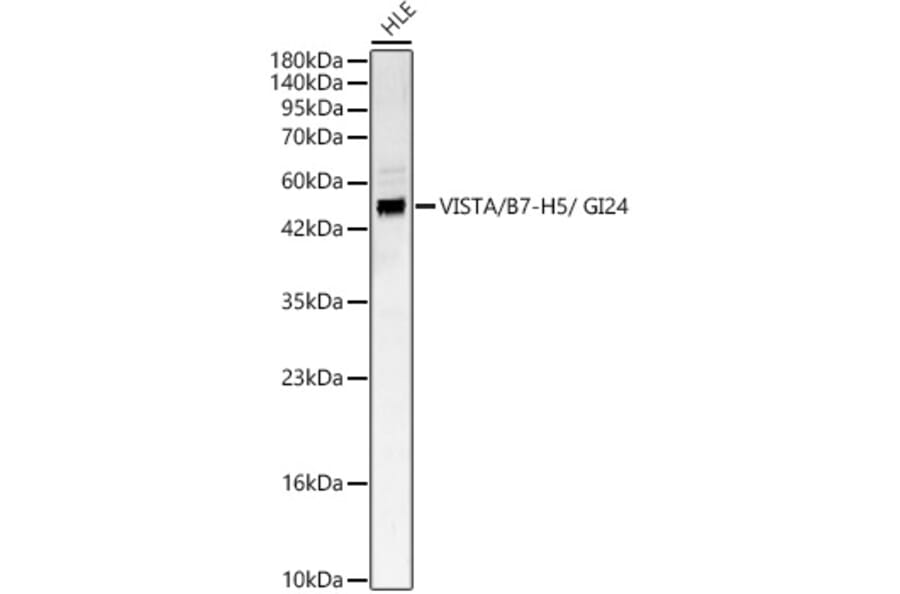 Western Blot - Anti-VISTA Antibody (A329960) - Antibodies.com