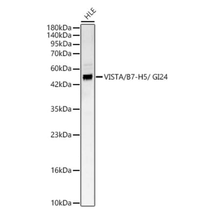Western Blot - Anti-VISTA Antibody (A329960) - Antibodies.com