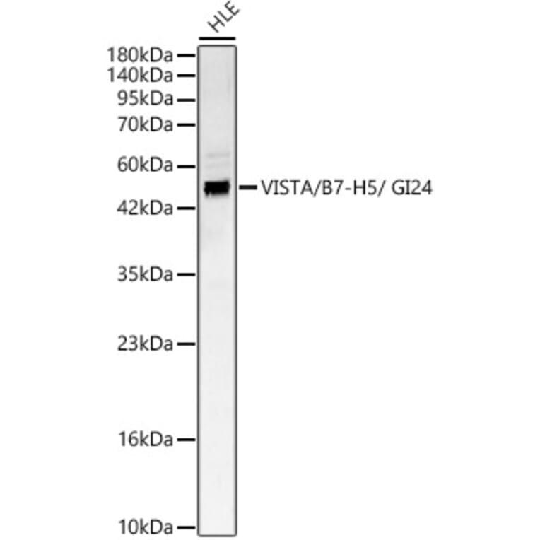 Western Blot - Anti-VISTA Antibody (A329960) - Antibodies.com