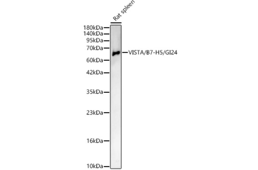Western Blot - Anti-VISTA Antibody (A329960) - Antibodies.com