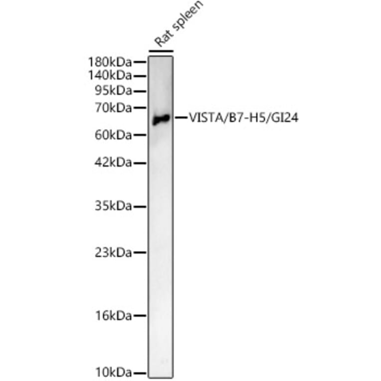 Western Blot - Anti-VISTA Antibody (A329960) - Antibodies.com