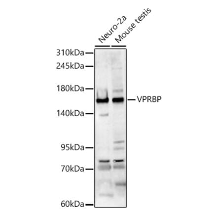 Western Blot - Anti-VPRBP Antibody (A329962) - Antibodies.com